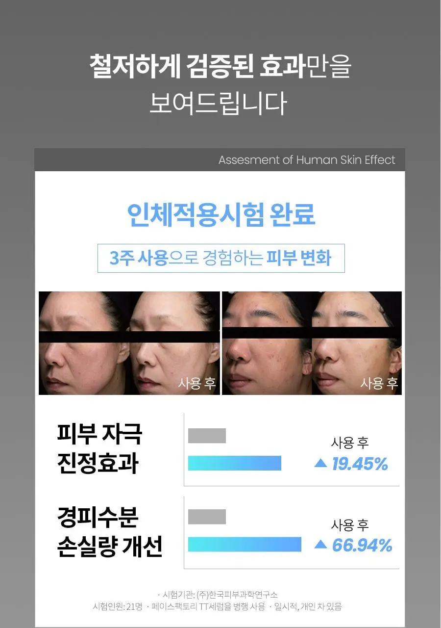 [피지제거/필링] 페이스팩토리 제트 필링기 상세페이지 42
